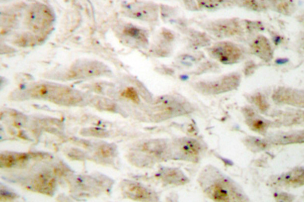 IHC of LIMK2 (K491) pAb in paraffin-embedded human brain tissue.