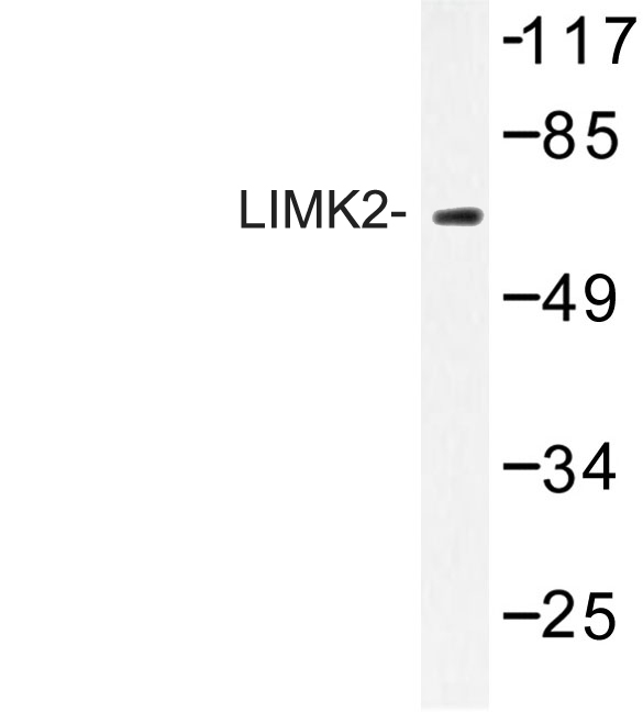 Western blot of LIMK2 (K491) pAb in extracts from HepG2 cells.