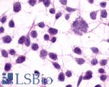 Anti-GRM3 / MGLUR3 antibody LS-A899 immunocytochemistry (ICC) staining of untransfected HEK293 human embryonic kidney cells.