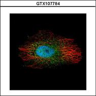 Confocal immunofluorescence analysis (Olympus FV10i) of paraformaldehyde-fixed HeLa using LIM kinase 2 antibody (Green) at 1:500 dilution. Alpha-tubulin filaments were labeled with alpha-tubulin antibody (Red) at 1:2000.