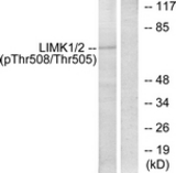 Western blot of extracts from COLO205 cells, using LIMK2 (Phospho-Thr505) Antibody. The lane on the right was incubated with synthetic peptide.