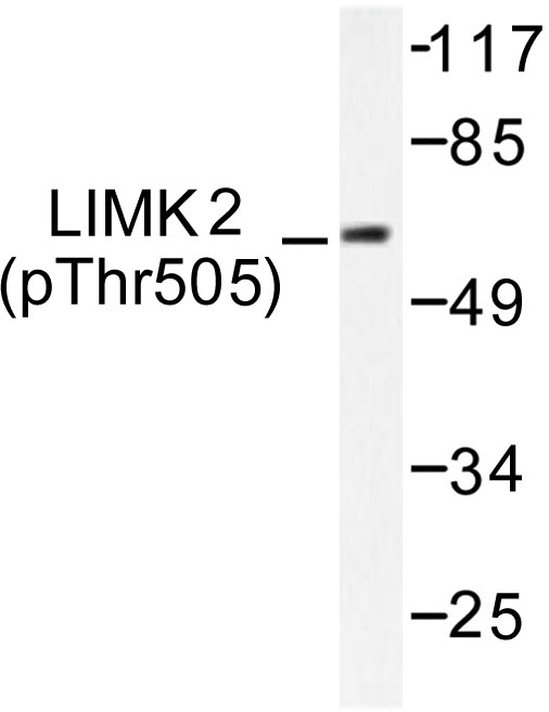 Western blot of p-LIMK2 (T505) pAb in extracts from COLO cells.