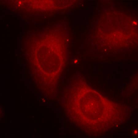 Immunofluorescence staining of methanol-fixed HeLa cells using LIMK2(Phospho-Thr505) antibody.