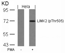 Western blot of extracts from HeLa cells untreated or treated with PMA using LIMK2(Phospho-Thr505) antibody.