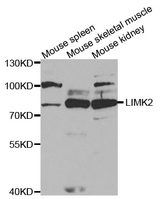 Western blot analysis of extracts of various cell lines, using LIMK2 antibody.