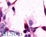 Anti-GRM3 / MGLUR3 antibody LS-A899 immunocytochemistry (ICC) staining of HEK293 human embryonic kidney cells transfected with GRM3 / MGLUR3.