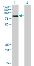 Western Blot analysis of LIMK2 expression in transfected 293T cell line by LIMK2 monoclonal antibody (M01), clone 2H2-E11.Lane 1: LIMK2 transfected lysate(72.232 KDa).Lane 2: Non-transfected lysate.