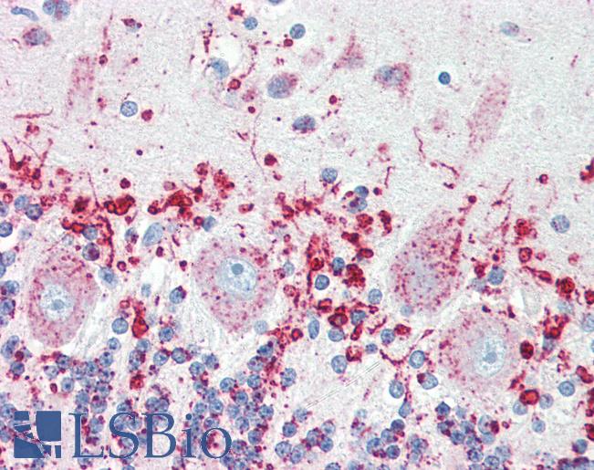 Anti-SCARB2 antibody IHC of human brain, cerebellum. Immunohistochemistry of formalin-fixed, paraffin-embedded tissue after heat-induced antigen retrieval. Antibody LS-B3225 concentration 5 ug/ml.