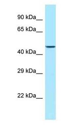 LIMS1 / PINCH antibody Western Blot of MCF7 cell lysate.