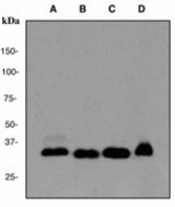 Western blot analysis on (A) Jurkat (B) K562 C) HeLa and (D) 293 cell lysates using anti-LIMS1 antibody (LS-C105332), dilution 1:5000.