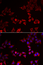Immunofluorescence analysis of A549 cell using LIMS1 antibody. Blue: DAPI for nuclear staining.