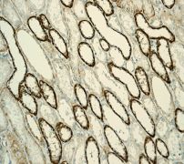 Immunohistochemical staining of paraffin-embedded Human kidney tissue using anti-LIMS1 antibody at 1/100 dilution.