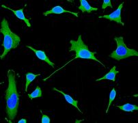 Immunofluorescent staining of HeLa cells using anti-LIMS1 antibody.