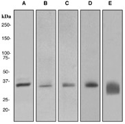Western blot analysis on (A) 293T, (B) HeLa, (C) Jurkat, (D) fetal kidney, and (E) human spleen cell lysates using anti-LIMS1 antibody.