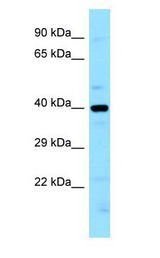 LIMS2 antibody Western Blot of MCF7.