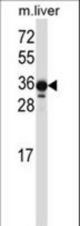 LIMS2 Antibody western blot of mouse liver tissue lysates (35 ug/lane). The LIMS2 antibody detected the LIMS2 protein (arrow).