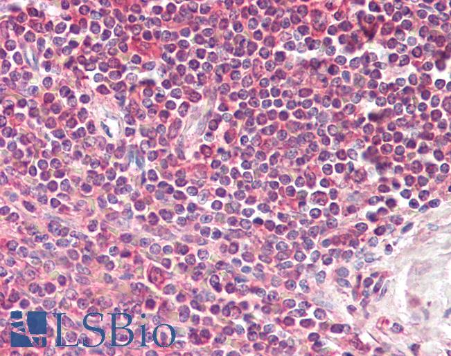 Anti-LIMS2 antibody IHC of human spleen. Immunohistochemistry of formalin-fixed, paraffin-embedded tissue after heat-induced antigen retrieval. Antibody LS-B7405 concentration 3.75 ug/ml.