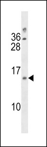 LIMS3/LIMS3L Antibody western blot of 293 cell line lysates (35 ug/lane). The LIMS3/LIMS3L antibody detected the LIMS3/LIMS3L protein (arrow).