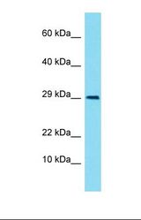 Western blot of Human Fetal Kidney. LIMS3 antibody dilution 1.0 ug/ml.