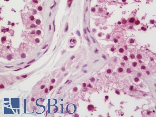 Human Testis: Formalin-Fixed, Paraffin-Embedded (FFPE)
