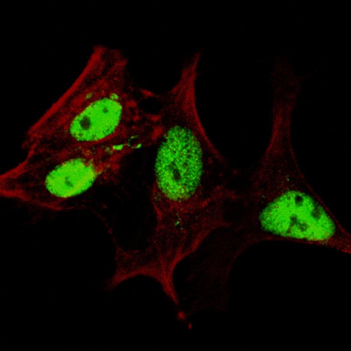 Fluorescent confocal image of SY5Y cells stained LIN28A antibody. SY5Y cells were fixed with 4% PFA (20 min), permeabilized with Triton X-100 (0.2%, 30 min), then incubated LIN28A primary antibody (1:200, 2 h at room temperature). For secondary antibody, Alexa Fluor 488 conjugated donkey anti-rabbit antibody (green) was used (1:1000, 1h). Cytoplasmic actin was counterstained with Alexa Fluor 555 (red) conjugated Phalloidin (5.25 mu M, 25 min). Lin28a immunoreactivity is localized very specifically to the nuclei of the SY5Y cells.