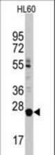 Western blot of LIN28B Antibody in HL60 cell line lysates (35 ug/lane). LIN28B (arrow) was detected using the purified antibody.