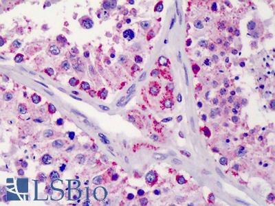 Anti-LIN28B antibody IHC of human testis. Immunohistochemistry of formalin-fixed, paraffin-embedded tissue after heat-induced antigen retrieval. Antibody LS-B3423 concentration 10 ug/ml.