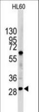 Western blot of LIN28B Antibody in HL60 cell line lysates (35 ug/lane). LIN28B (arrow) was detected using the purified antibody.