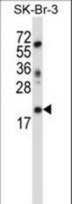 LIN52 Antibody (N-term ) western blot of SK-BR-3 cell line lysates (35 ug/lane). The LIN52 antibody detected the LIN52 protein (arrow).