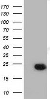 HEK293T cells were transfected with the pCMV6-ENTRY control (Left lane) or pCMV6-ENTRY LIN7B (Right lane) cDNA for 48 hrs and lysed. Equivalent amounts of cell lysates (5 ug per lane) were separated by SDS-PAGE and immunoblotted with anti-LIN7B.