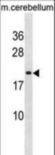 LIN7B Antibody western blot of mouse cerebellum tissue lysates (35 ug/lane). The LIN7B antibody detected the LIN7B protein (arrow).