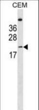 LIN7B Antibody western blot of CEM cell line lysates (35 ug/lane). The LIN7B antibody detected the LIN7B protein (arrow).
