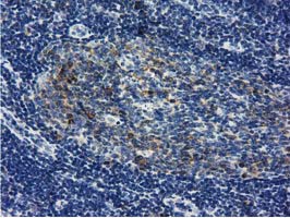 IHC of paraffin-embedded Human lymph node tissue using anti-LIN7B mouse monoclonal antibody. (Dilution 1:50).