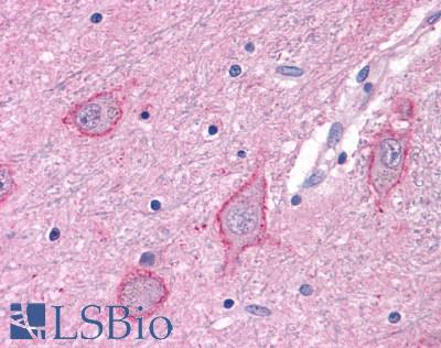 Anti-GRM3 / MGLUR3 antibody LS-A3218 IHC of human brain, neurons and glia. Immunohistochemistry of formalin-fixed, paraffin-embedded tissue after heat-induced antigen retrieval.