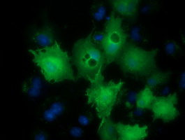 Anti-LIN7B mouse monoclonal antibody immunofluorescent staining of COS7 cells transiently transfected by pCMV6-ENTRY LIN7B.