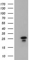 HEK293T cells were transfected with the pCMV6-ENTRY control (Left lane) or pCMV6-ENTRY LIN7B (Right lane) cDNA for 48 hrs and lysed. Equivalent amounts of cell lysates (5 ug per lane) were separated by SDS-PAGE and immunoblotted with anti-LIN7B.