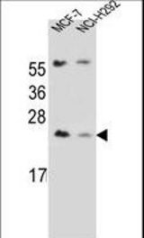 LIN7C Antibody western blot of MCF-7,NCI-H292 cell line lysates (35 ug/lane). The LIN7C antibody detected the LIN7C protein (arrow).
