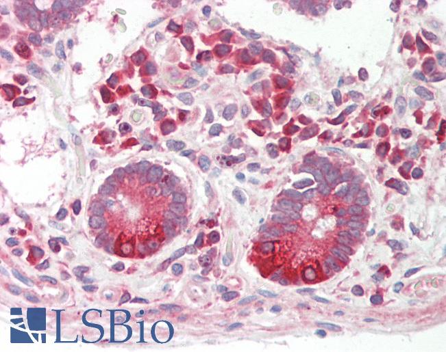 Human Small Intestine: Formalin-Fixed, Paraffin-Embedded (FFPE)