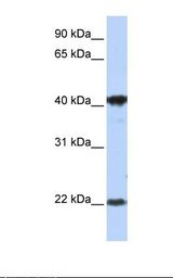 MCF7 cell lysate. Antibody concentration: 1.0 ug/ml. Gel concentration: 12%.