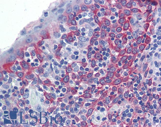 Anti-LIN7C antibody IHC of human tonsil. Immunohistochemistry of formalin-fixed, paraffin-embedded tissue after heat-induced antigen retrieval. Antibody LS-B3550 concentration 5 ug/ml.