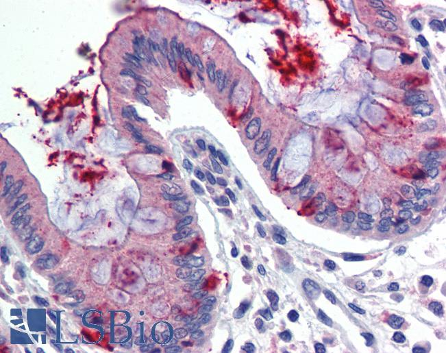 Anti-LIN7C antibody IHC of human colon. Immunohistochemistry of formalin-fixed, paraffin-embedded tissue after heat-induced antigen retrieval. Antibody LS-B3550 concentration 5 ug/ml.