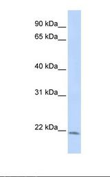 HepG2 cell lysate. Antibody concentration: 1.0 ug/ml. Gel concentration: 12%.