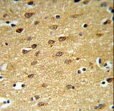 LINGO-1(LRRN6A)-S596 Antibody IHC of formalin-fixed and paraffin-embedded brain tissue followed by peroxidase-conjugated secondary antibody and DAB staining. This data demonstrates the use of the LINGO-1(LRRN6A)-S596 Antibody for immunohistochemistry.