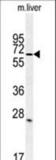 Western blot of LINGO-1(LRRN6A)in mouse liver tissue lysates (35 ug/lane). LRRN6A (arrow) was detected using the purified antibody.
