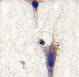 Formalin-fixed and paraffin-embedded human brain tissue reacted with LINGO1 Antibody , which was peroxidase-conjugated to the secondary antibody, followed by DAB staining. This data demonstrates the use of this antibody for immunohistochemistry; clinical relevance has not been evaluated.