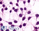 Anti-GRM3 / MGLUR3 antibody LS-A3218 immunocytochemistry (ICC) staining of untransfected HEK293 human embryonic kidney cells.