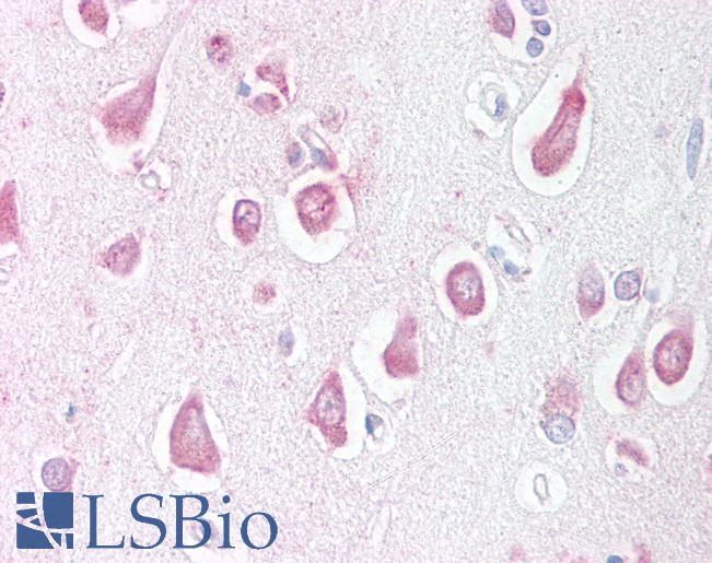 Anti-LINGO1 antibody LS-A9329 IHC of human brain, cortex. Immunohistochemistry of formalin-fixed, paraffin-embedded tissue after heat-induced antigen retrieval.