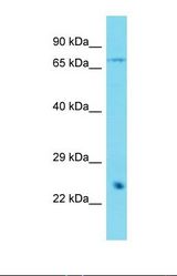 Western blot of Mouse Heart. Lingo2 antibody dilution 1.0 ug/ml.