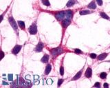 Anti-GRM3 / MGLUR3 antibody LS-A3218 immunocytochemistry (ICC) staining of HEK293 human embryonic kidney cells transfected with GRM3 / MGLUR3.