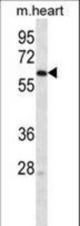 LINGO4 Antibody western blot of mouse heart tissue lysates (35 ug/lane). The LINGO4 antibody detected the LINGO4 protein (arrow).